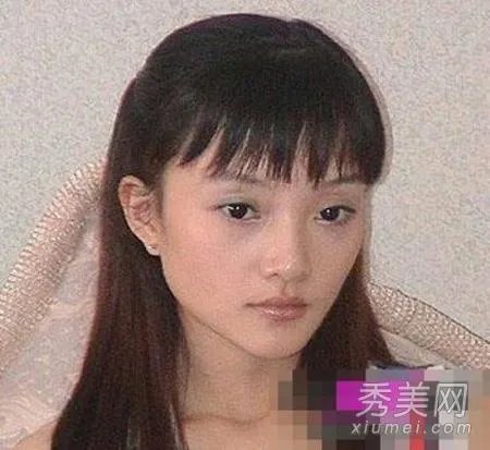 有哪些整容失败的女明星？