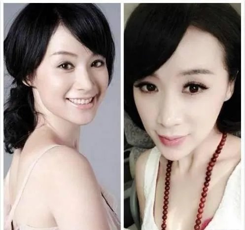 有哪些整容失败的女明星？