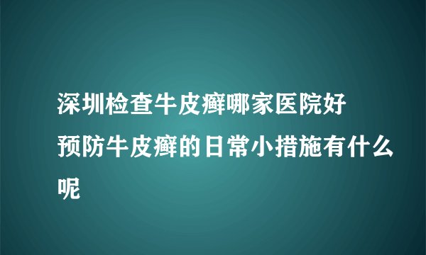深圳检查牛皮癣哪家医院好 预防牛皮癣的日常小措施有什么呢