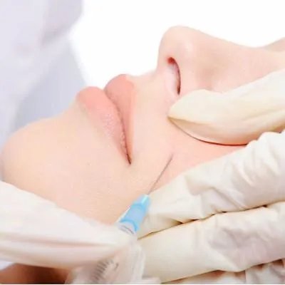 天河哪里祛斑好