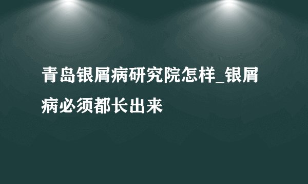 青岛银屑病研究院怎样_银屑病必须都长出来