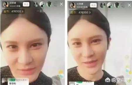 有哪些整容失败的女明星？