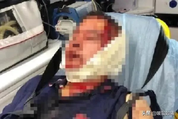 如何看待上海两名小学生打闹引发爸爸约架：一人头被敲破，警方已介入？