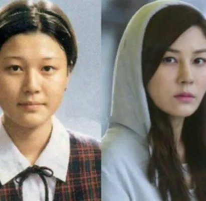 金荷娜整容照片大曝光 金荷娜整容前后对比照疑似隆鼻