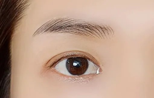 全切双眼皮哪家医院好