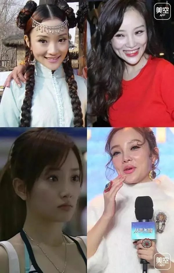 有哪些整容失败的女明星？