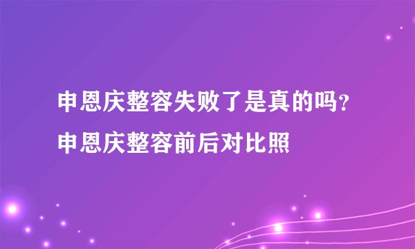 申恩庆整容失败了是真的吗？申恩庆整容前后对比照