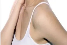 做假体隆胸取出医院哪里好