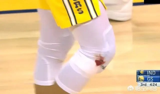 库里在和步行者比赛中膝盖流血，勇士却没有立马换下，裁判也未强制干预，这是为什么？