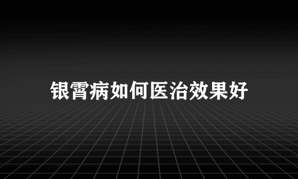 银霄病如何医治效果好