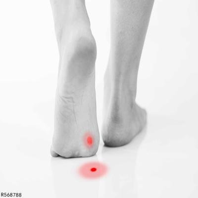 治疗脚鸡眼的偏方大全