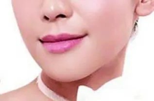 荨麻疹治疗方法