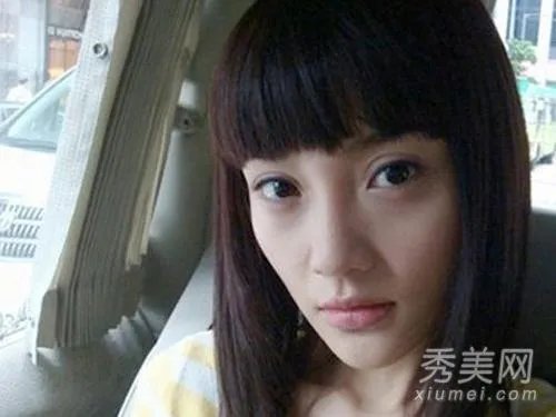 有哪些整容失败的女明星？