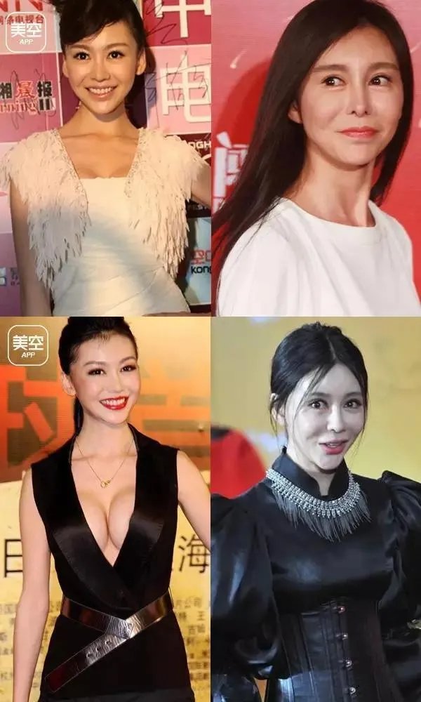 有哪些整容失败的女明星？