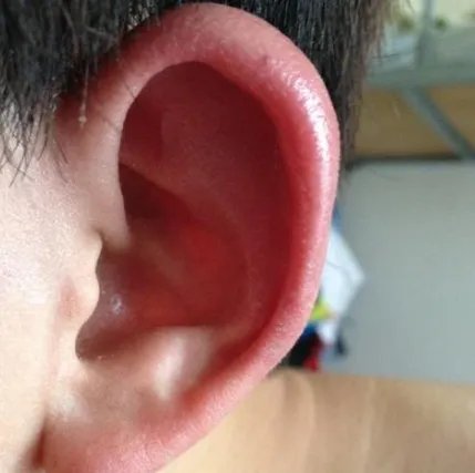 在人的五官中哪个器官最怕冷？