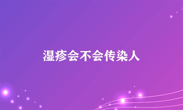 湿疹会不会传染人