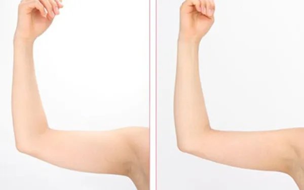 泄油瘦身汤管用吗