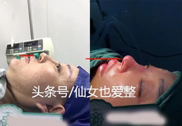 有哪些整容失败的女明星？