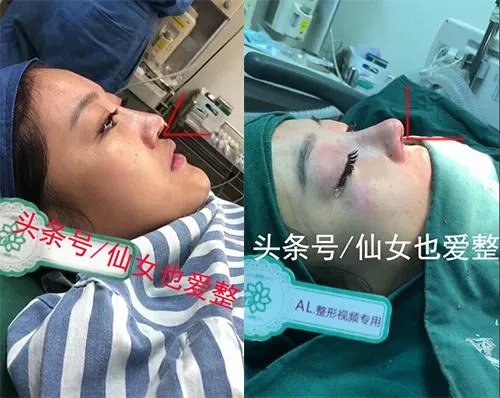 有哪些整容失败的女明星？