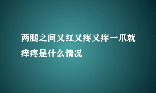 两腿之间又红又疼又痒一爪就痒疼是什么情况