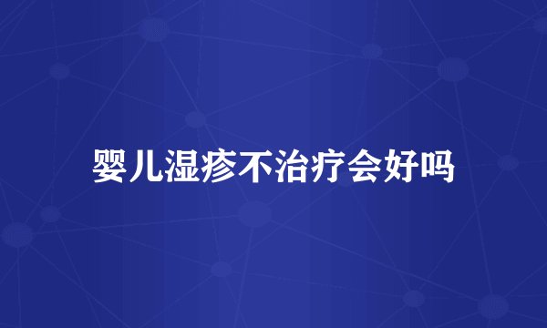 婴儿湿疹不治疗会好吗
