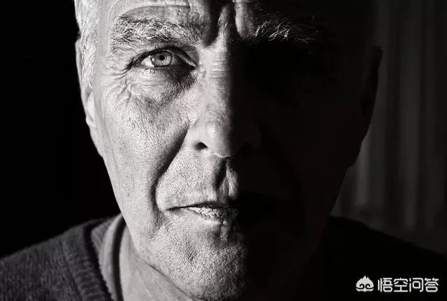 上睑下垂矫正术一定要做双眼皮吗