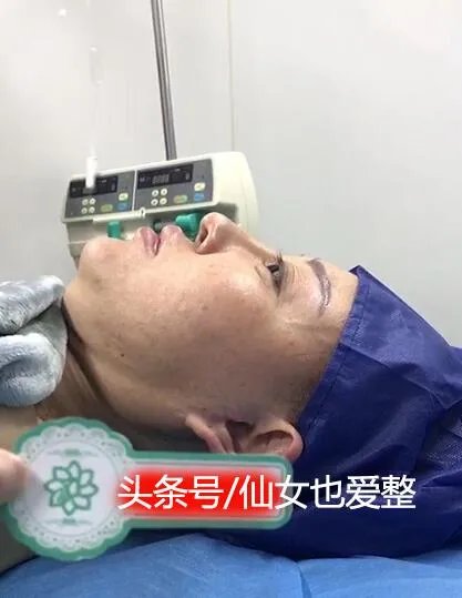 有哪些整容失败的女明星？