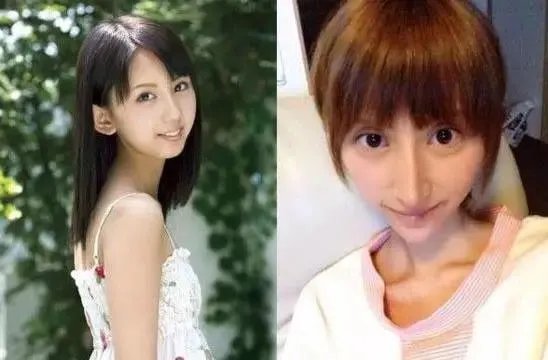 有哪些整容失败的女明星？