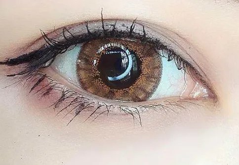 埋线重睑术应该注意什么