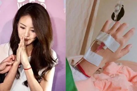 安以轩住院做手术 影迷心疼牵挂不已