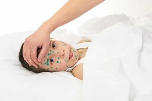 热射病长时间昏迷怎么办 如何护理热射病